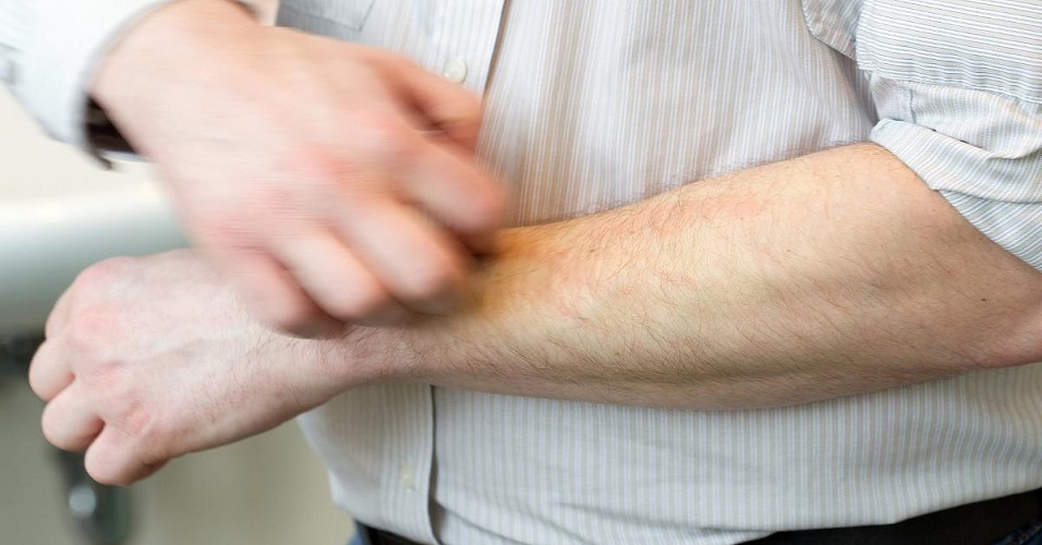 Герпетиформный дерматит