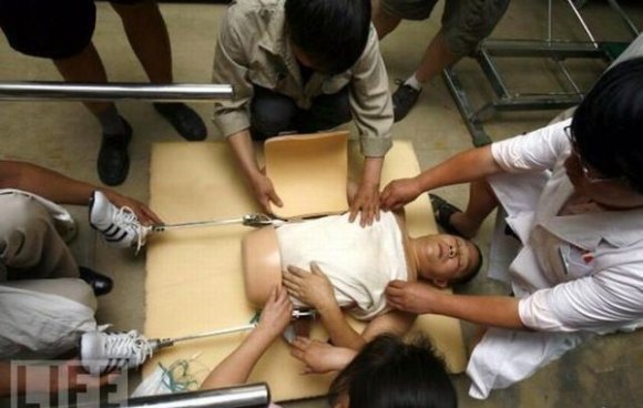 10 невероятных случаев в медицине