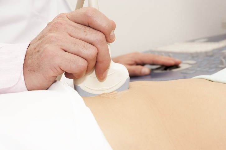 Рак яичника