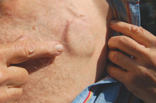 Тахикардия: современный подход к лечению