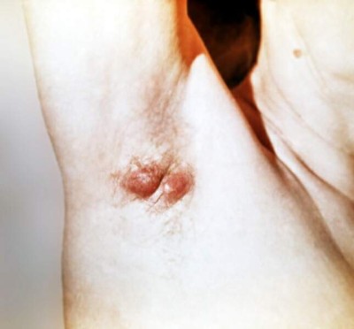 Почему может болеть рука?