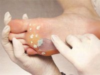 Скажите «стоп!» грибку стоп