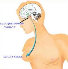 Пролактинома