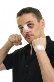 Травмы носа