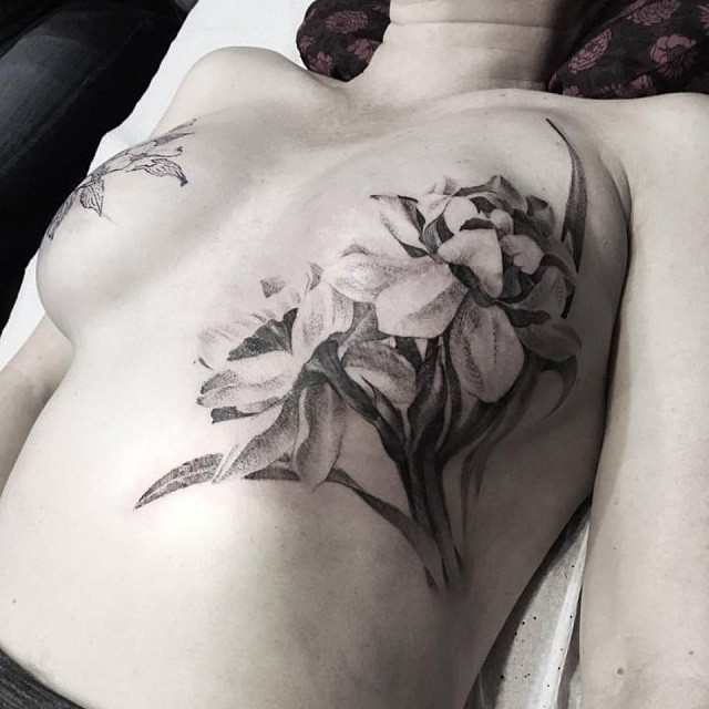 Как вернуть женственность после мастэктомии