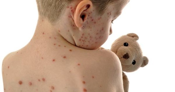 Инфекционный дерматит