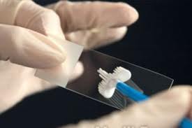 ВПЧ: вирус, который вызывает рак