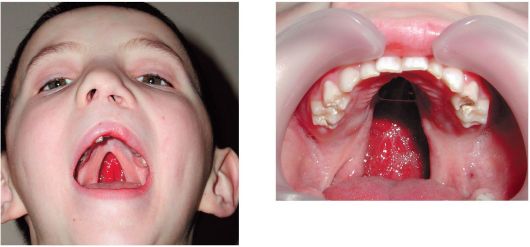 Расщелина неба