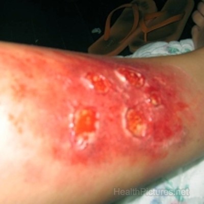 Как ухаживать за лежачими больными?