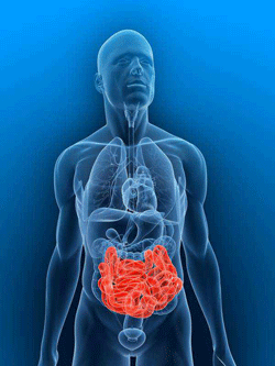 Аденоматозный полипоз кишечника