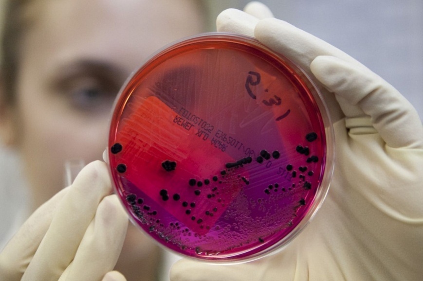 Сибирская язва