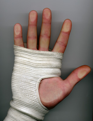 Почему может болеть рука?