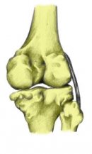 Разрыв/растяжение латеральной коллатеральной связки (наружной боковой связки)