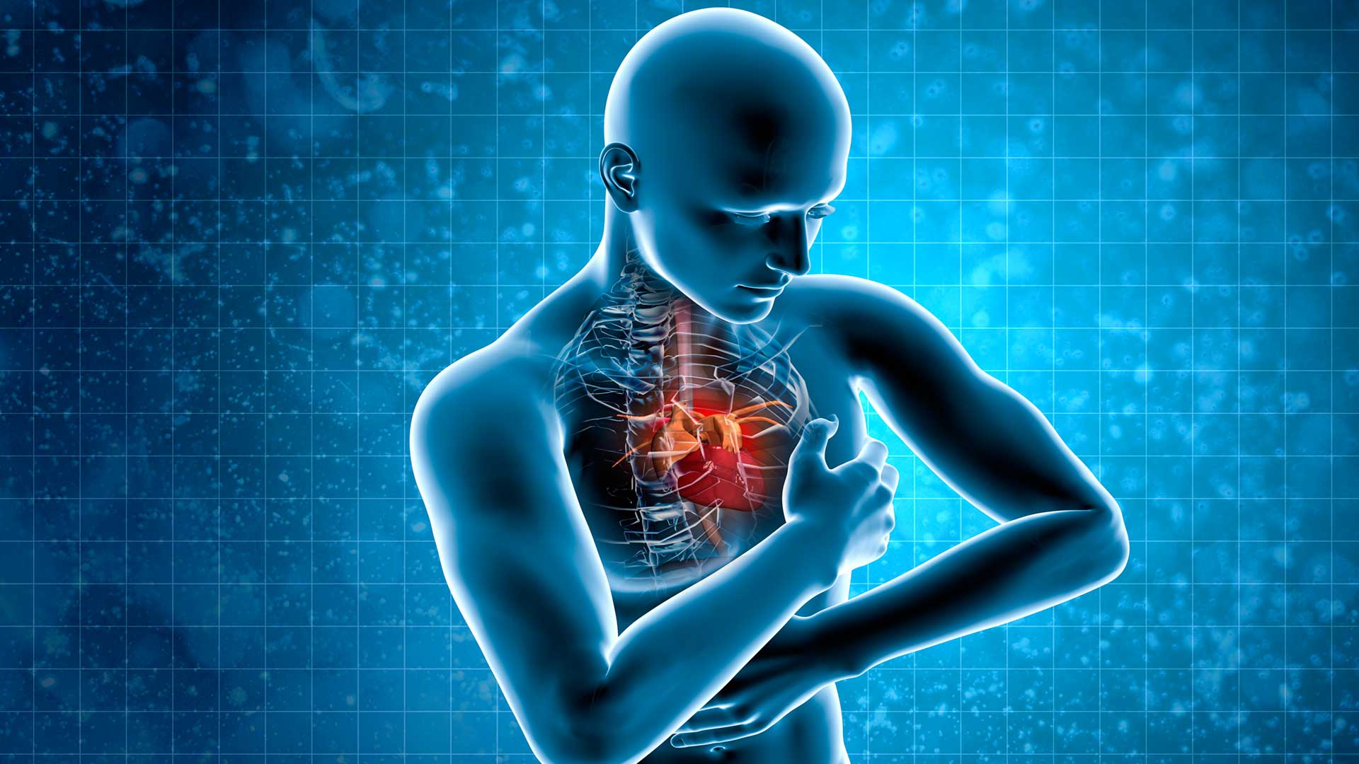 Гипертрофическая кардиомиопатия