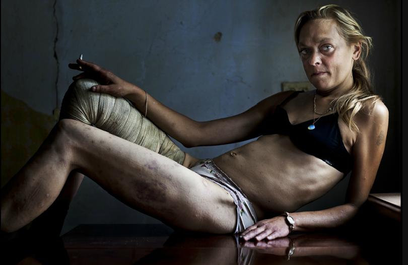 Зависимость от наркотиков