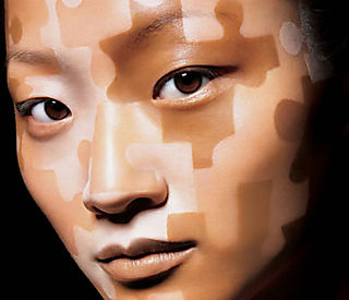 Найден способ победить седину и витилиго