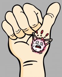 Чем грозят бородавки