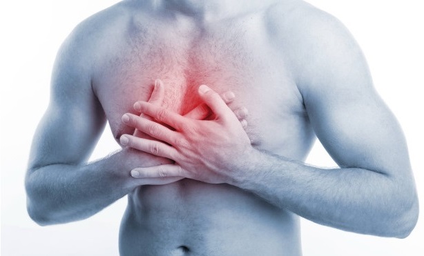 Синдром Титце