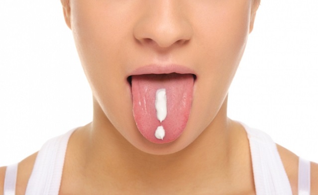 Кандидозный стоматит