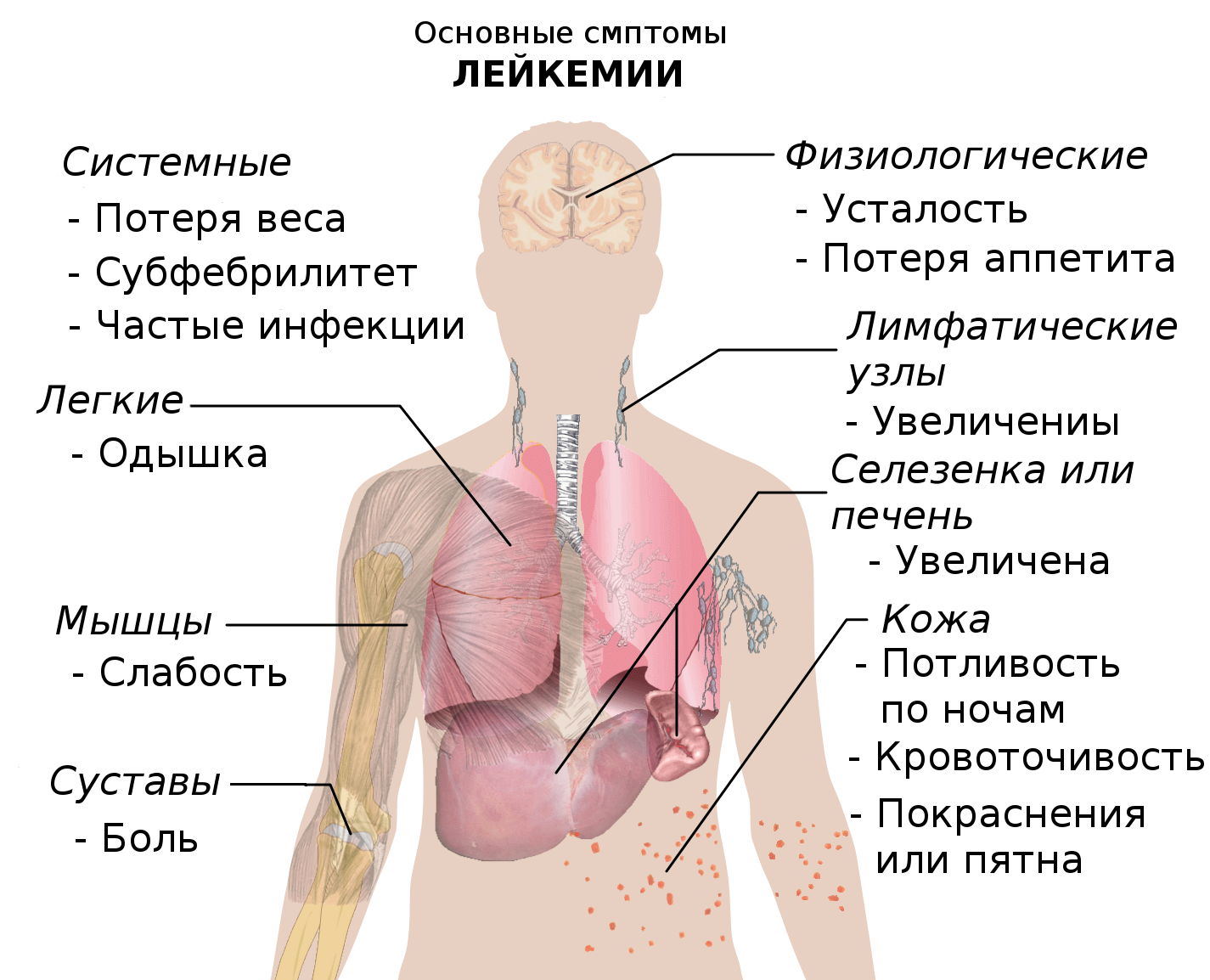 Как называются признаки болезни