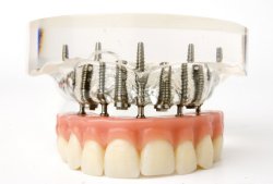 Как сформировать правильный прикус у ребенка