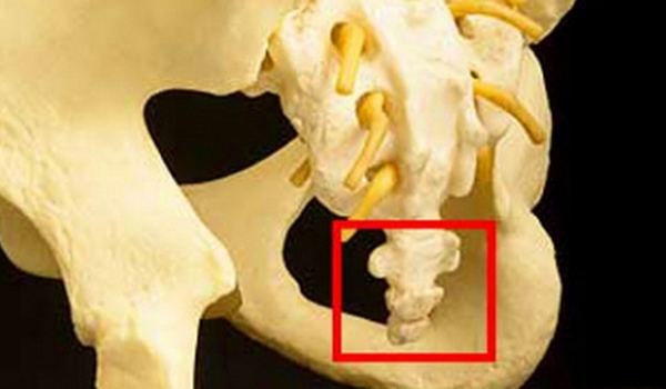 Боль в копчике