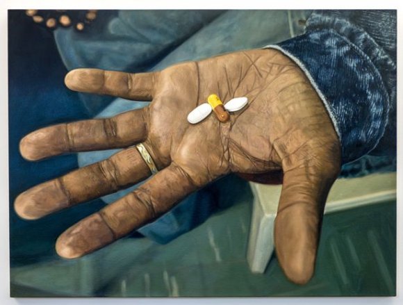 Как не нужно лечить молочницу в домашних условиях