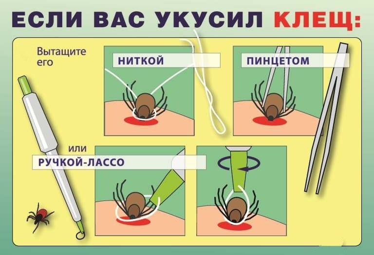 Как вытащить клеща. Чем опасен его укус