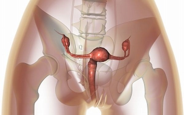 Рак влагалища