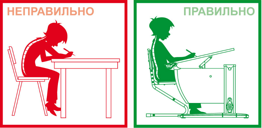 Нарушение осанки