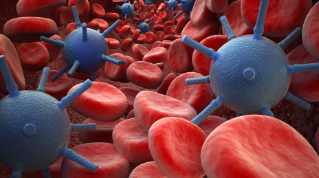 Макроглобулинемия Вальденстрема