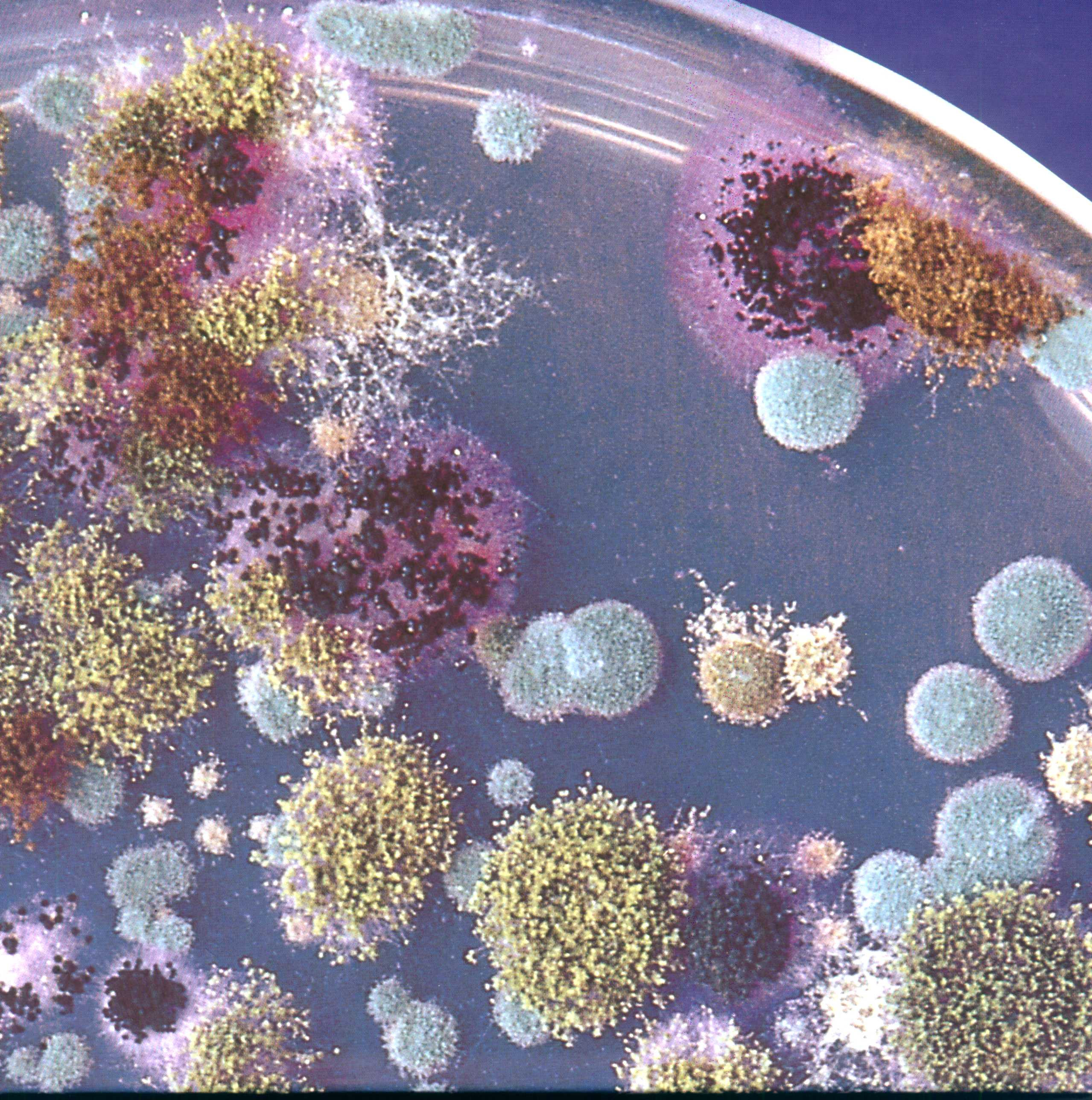 Плесень аллерген. Плесени микробиология. Плесневые грибы бактерии. Аллергены плесневых грибов.