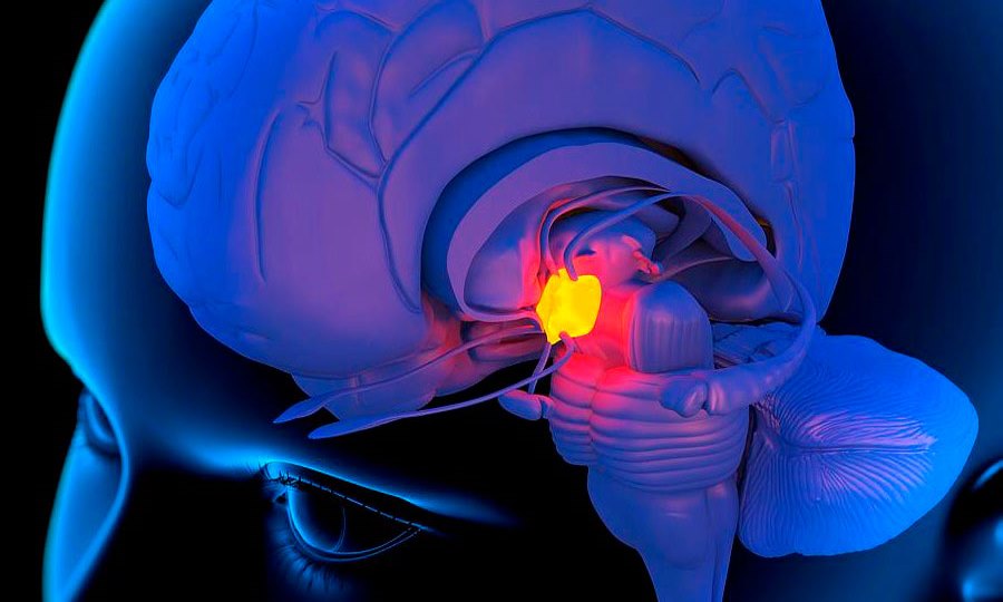 Болезнь Иценко-Кушинга