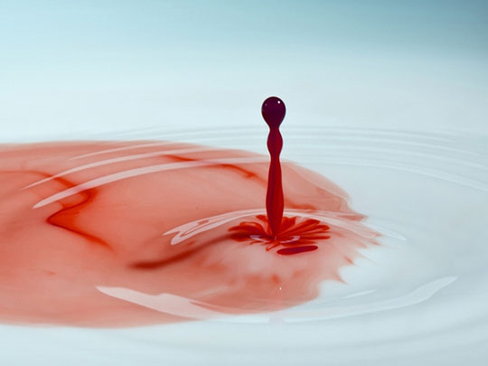 Кровь из носа (кровотечение из носа)