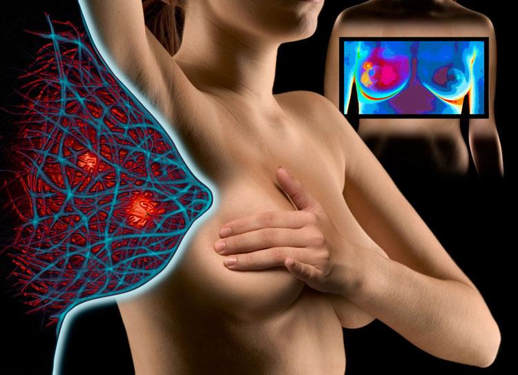 Выделения из соска